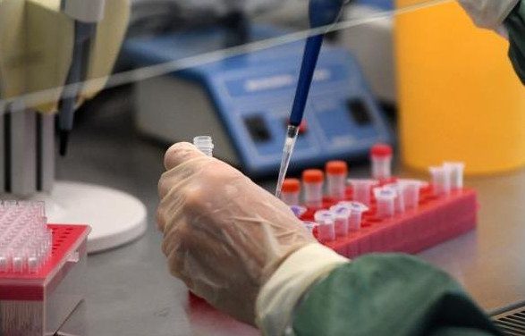 В России создан высокоточный тест на коронавирусную инфекцию