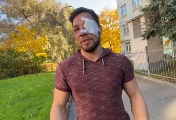 Москвич, жестоко избитый дагестанцами в метро, рассказал о последствиях нападения