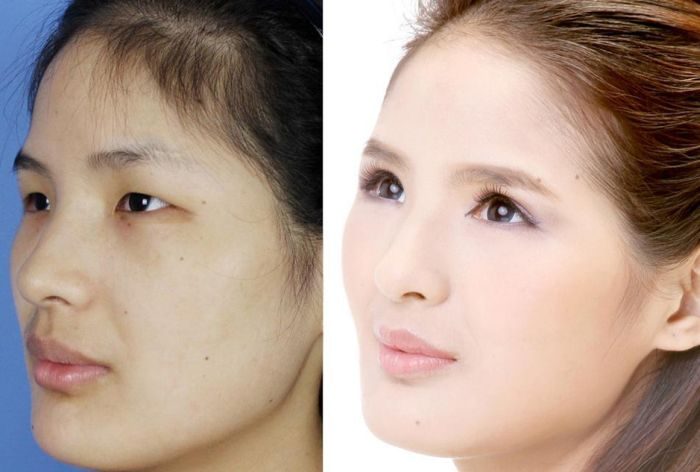 Как пластические операции изменили внешность китайских девушек