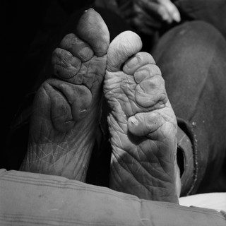 Ужасная китайская традиция бинтования ног