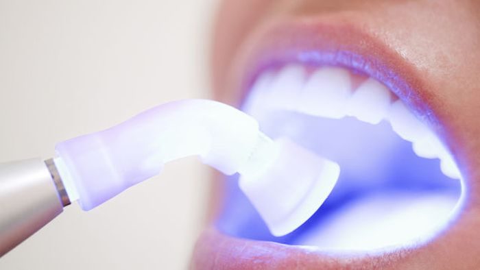 7 веществ, которые вредят вашим зубам