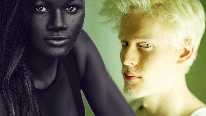 Люди с удивительным цветом кожи
