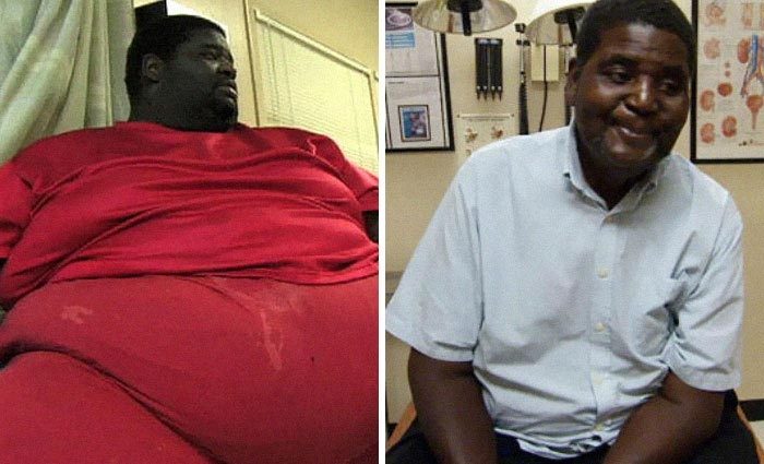 Невероятные фотографии людей до и после похудения