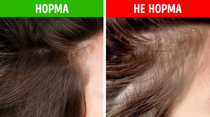 Что состояние волос расскажет о вашем здоровье