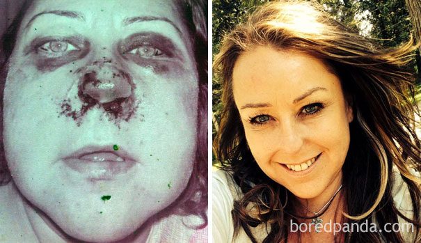 Фотографии людей после того, как они перестали принимать наркотики