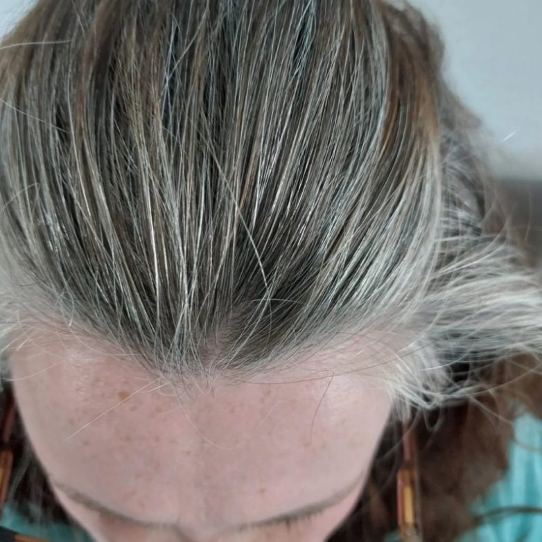 Что нужно знать о седых волосах