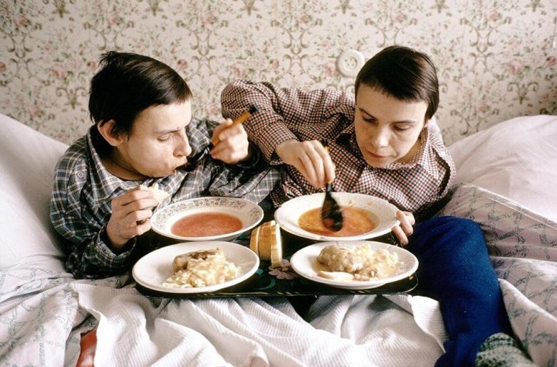 Как сложилась судьба первых сиамских близнецов в СССР