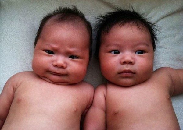 Самые трогательные фотографии близнецов