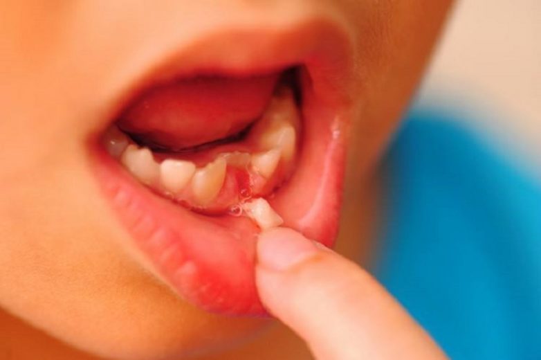 Почему не нужно отдавать молочные зубы зубной фее