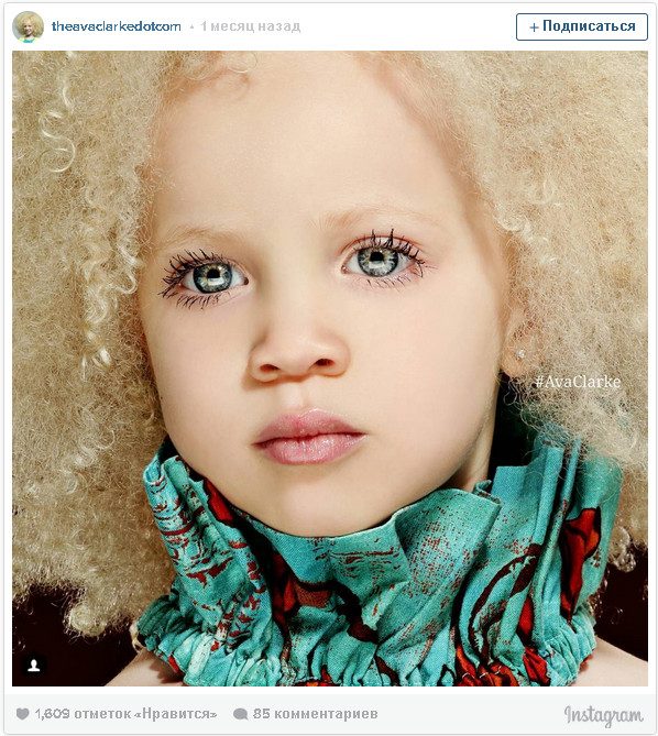 Девочка-альбинос стала моделью