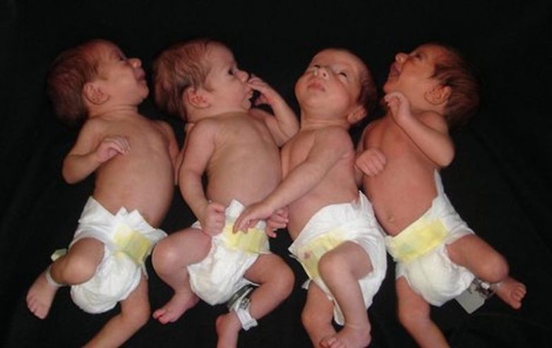 7 самых удивительных случаев многоплодных беременностей в истории