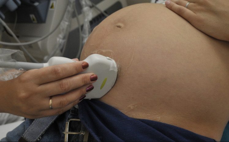 Что нужно знать будущей маме о родах в период пандемии коронавируса
