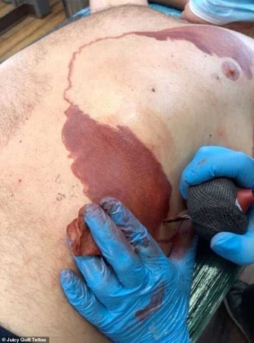 Отец сделал себе татуировку в виде родимого пятна, чтобы поддержать сына
