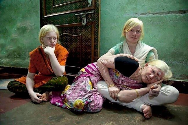 Самая большая в мире семья альбиносов из Индии