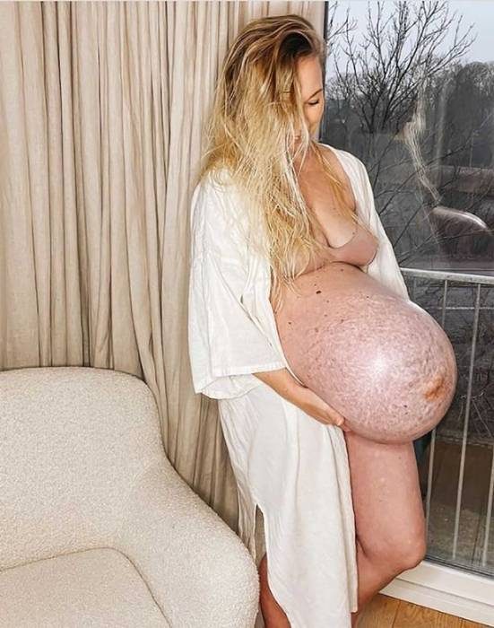 Беременная мама похвасталась «уникальным» животиком на 35 неделе