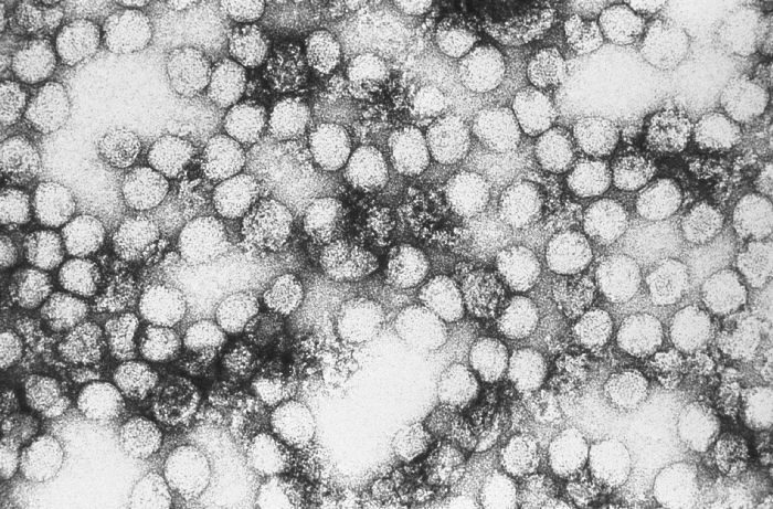 10 самых опасных болезней в истории, с которыми человечество сталкивалось до коронавируса