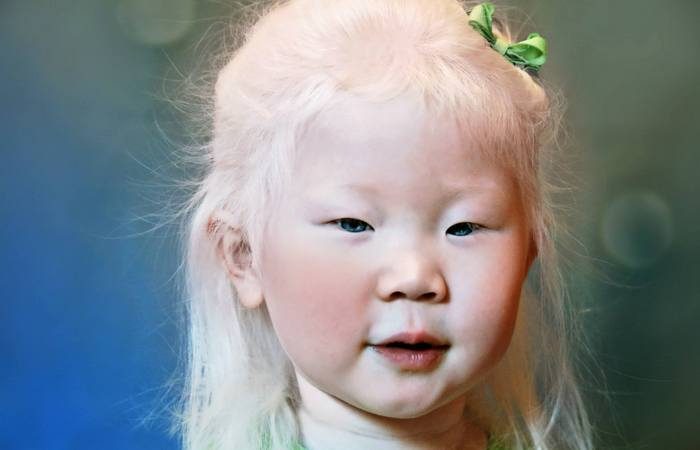 Невероятные и любопытные факты о людях-альбиносах
