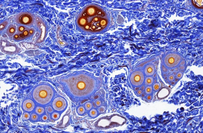 Учёные нашли клетку, которая вызывает рак