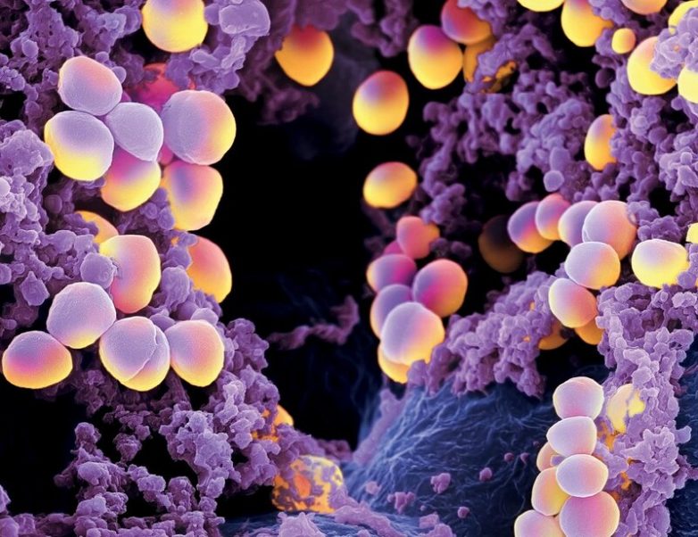 10 самых опасных бактерий в мире