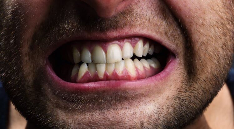 Вопрос на засыпку: почему зубы — это не кости?