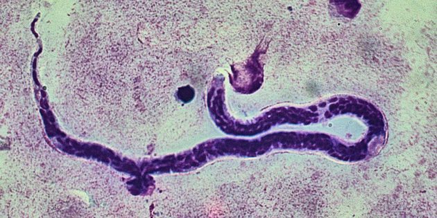 5 самых отвратительных паразитов, которые могут обитать в человеческом теле
