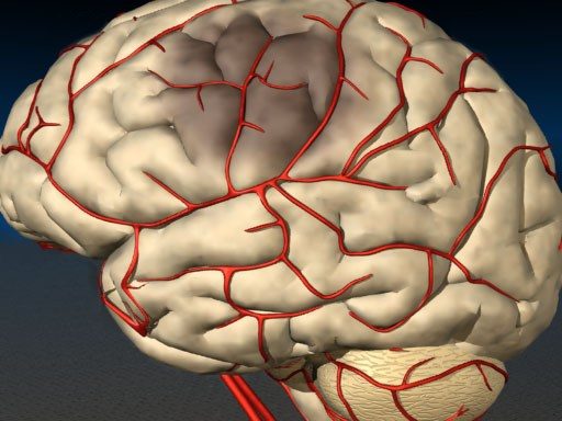 5 способов очистки сосудов головного мозга