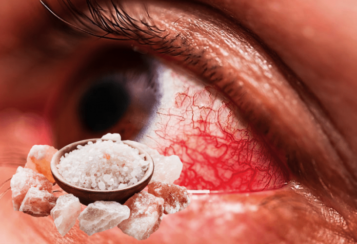 Солевой раствор поможет при глазной инфекции!
