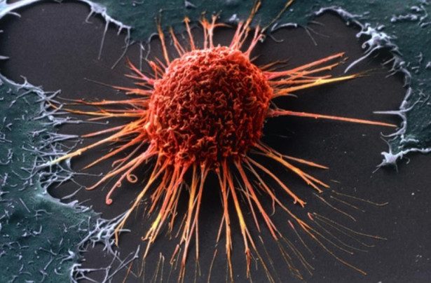 Учёные назвали признак скорого появления рака