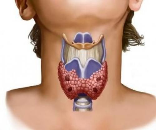 Очищаем щитовидную железу
