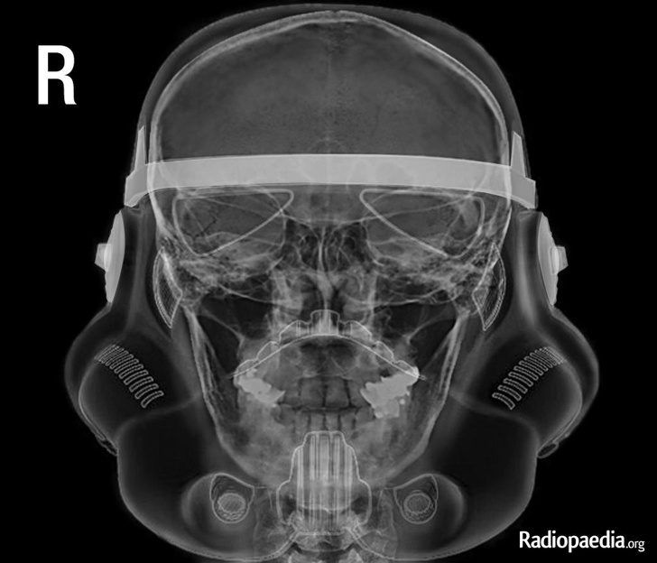 Рентгеновские снимки, которые расскажут лучше, чем учебник по анатомии