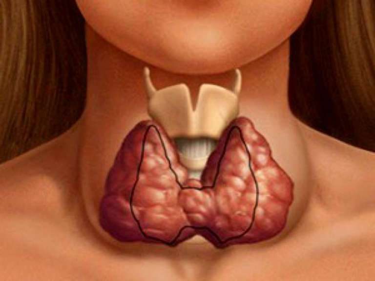 Как улучшить функцию щитовидной железы