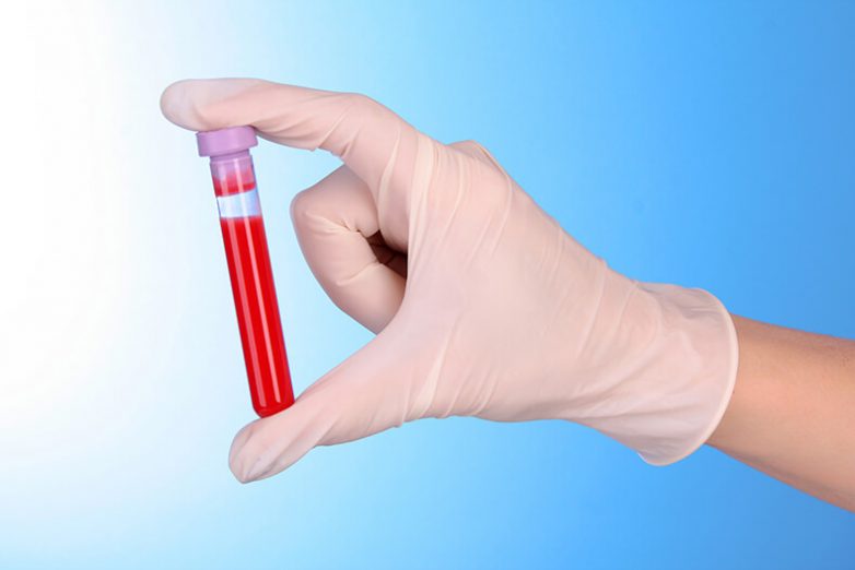 О чём может рассказать биохимический анализ крови