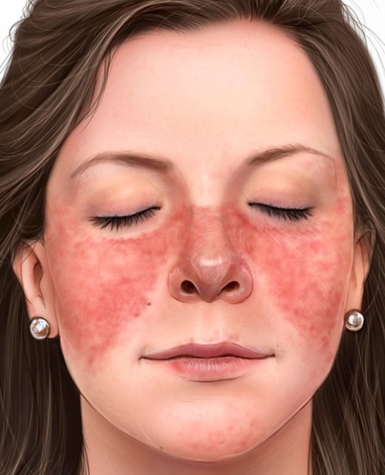 Сигналы кожи, которые предупреждают о серьезных заболеваниях