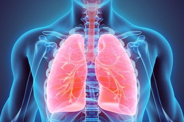 Что важно знать о раке лёгкого