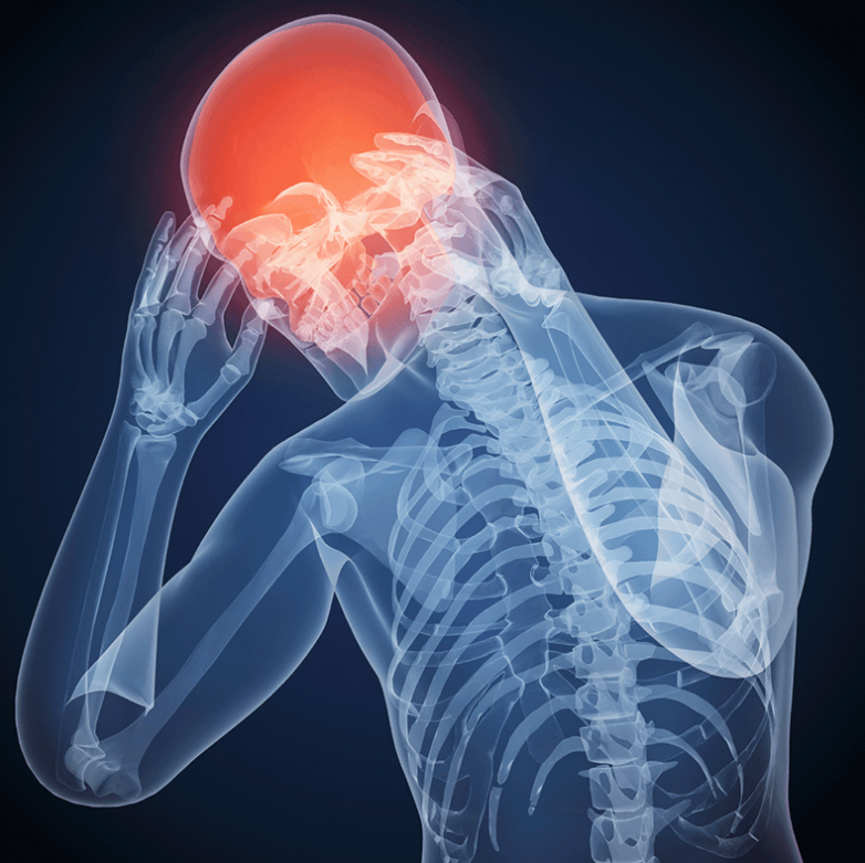 Чем могут быть вызваны хронические головные боли