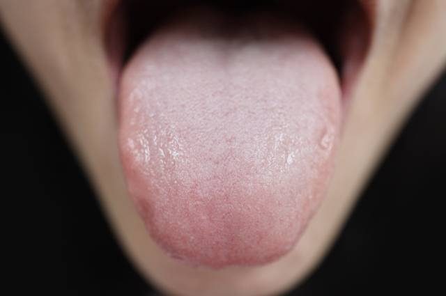 Почему травмирование языка чревато опухолями