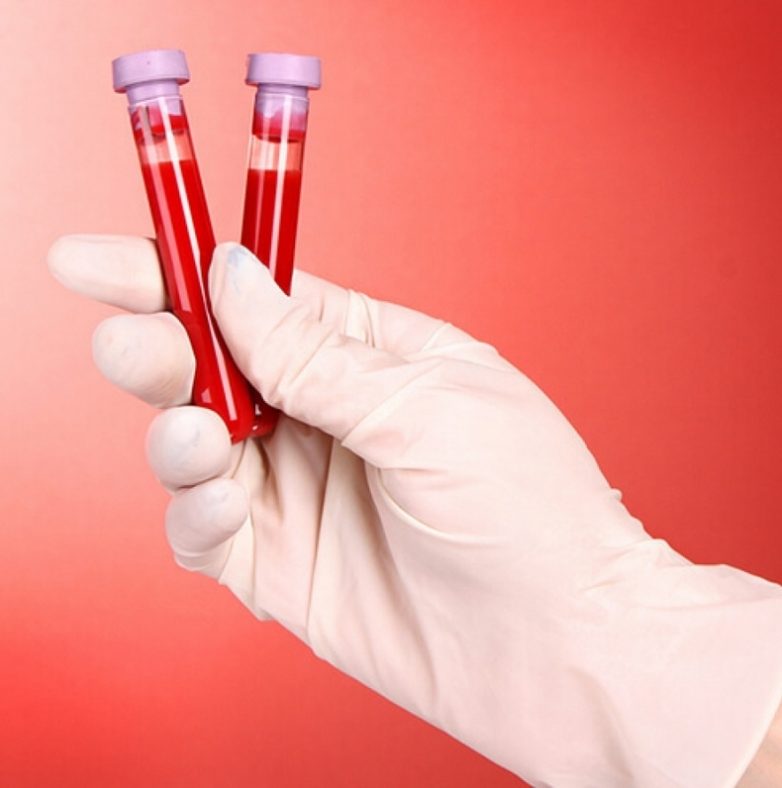 8 маркеров крови и как их улучшить