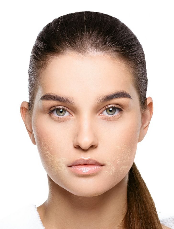 9 продуктов, которые дерматологи не рекомендуют наносить на кожу лица
