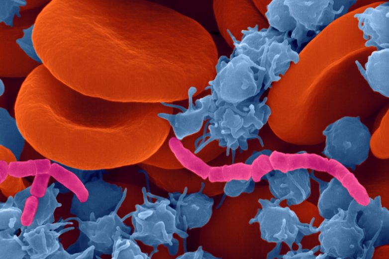 Что за бактерию, вызывающую целлюлит, обнаружили ученые?