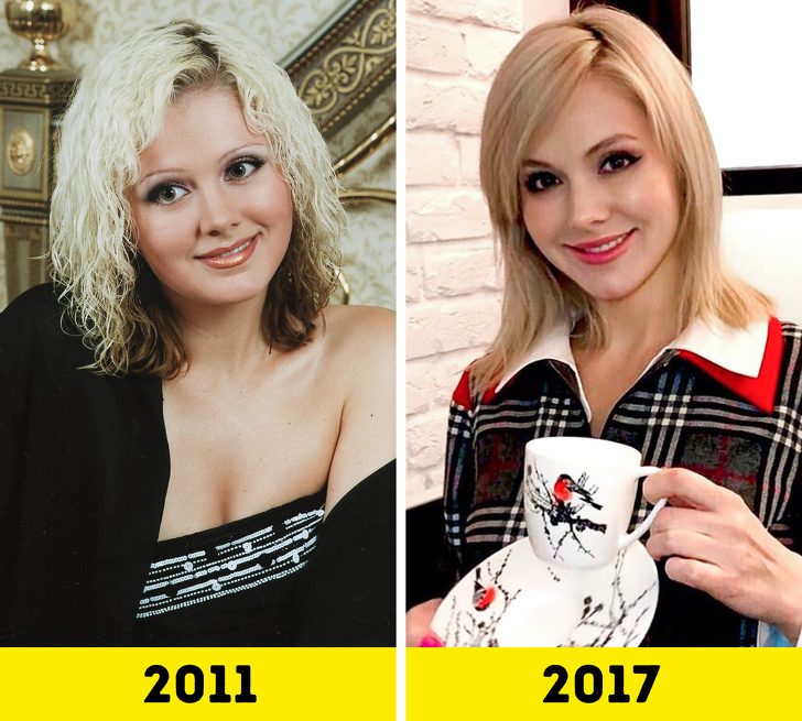 Российские звёзды, которые стали выглядеть моложе