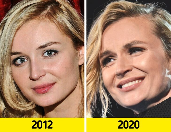 Как с годами изменились лица наших знаменитостей