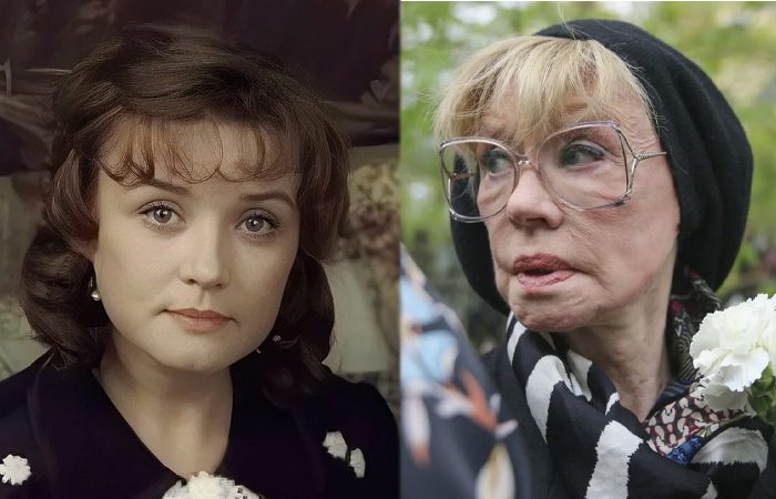 Какими были знаменитости в начале карьеры и как они выглядят сейчас