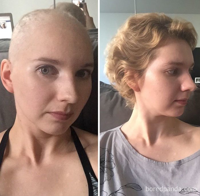 Люди, победившие рак. До и После