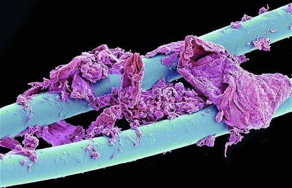 10 удивительных примеров как выглядят привычные вещи под микроскопом