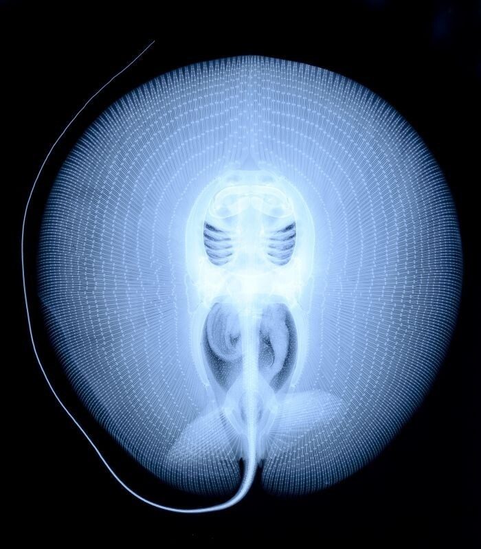 Рентгеновские снимки, которые откроют вам мир с неожиданной стороны