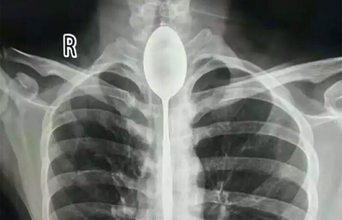 Рентгеновские снимки, которые откроют вам мир с неожиданной стороны