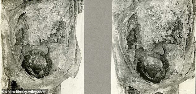 Шок! Внутри древнеегипетской мумии нашли нерожденных близнецов